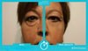 Анна И. — новый покупатель оригинального Instantly Ageless