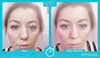 Мнение эксперта Кэти Ристинг о микрокреме Instantly Ageless в флаконах