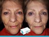 Кэрол — отзыв о стойкости микрокрема Instantly Ageless в течение дня