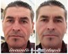 Отзыв Бруно об использовании Instantly Ageless для мужчин